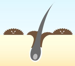 図：毛根洗浄前